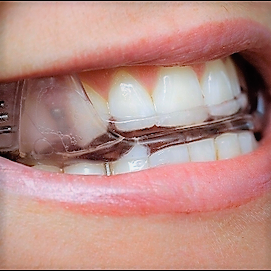 DAM ( Dispositivo de Adelantamiento Mandibular), Contacte con MyRespira para disponibilidad según zona geografica